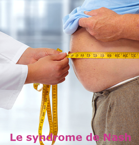 Syndrome de Nash